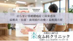 治らない掌蹠膿疱症と病巣感染｜扁桃炎・虫歯・歯周病の治療と扁桃摘出術