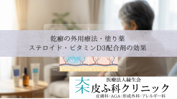 乾癬の外用療法・塗り薬｜ステロイド・ビタミンD3配合剤（ドボベット）の効果