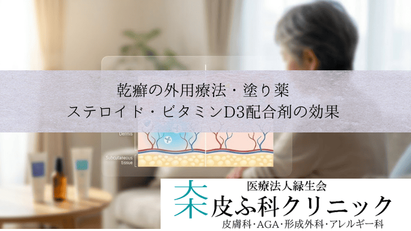 乾癬の外用療法・塗り薬｜ステロイド・ビタミンD3配合剤（ドボベット）の効果