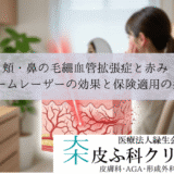 頬・鼻の毛細血管拡張症と赤み｜Vビームレーザーの効果と保険適用の条件