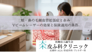 頬・鼻の毛細血管拡張症と赤み｜Vビームレーザーの効果と保険適用の条件