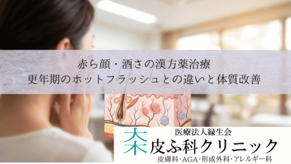 赤ら顔・酒さの漢方薬治療｜更年期のホットフラッシュとの違いと体質改善