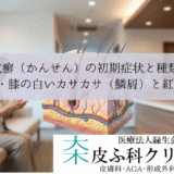 乾癬（かんせん）の初期症状と種類｜肘・膝の白いカサカサ（鱗屑）と紅斑