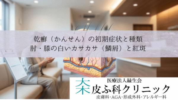 乾癬（かんせん）の初期症状と種類｜肘・膝の白いカサカサ（鱗屑）と紅斑
