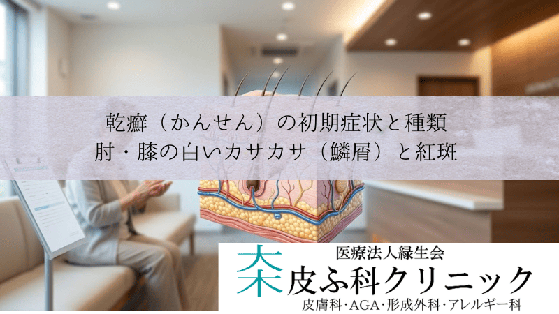 乾癬(かんせん)の初期症状と種類|肘・膝の白いカサカサ(鱗屑)と紅斑