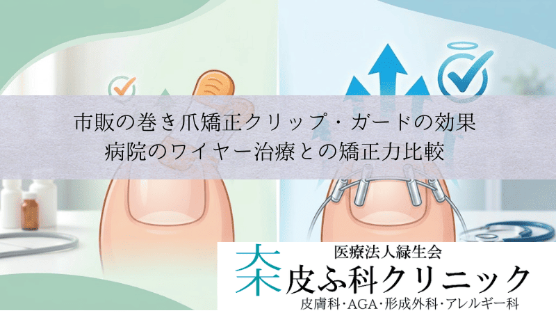 市販の巻き爪矯正クリップ・ガードの効果｜病院のワイヤー治療との矯正力比較