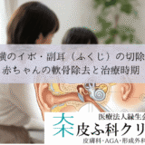 耳の横のイボ・副耳（ふくじ）の切除手術｜赤ちゃんの軟骨除去と治療時期
