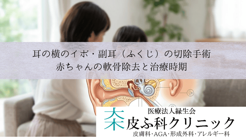 耳の横のイボ・副耳（ふくじ）の切除手術｜赤ちゃんの軟骨除去と治療時期