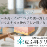 スピール膏・イボコロリの使い方と失敗｜白くふやけた後の正しい削り方