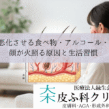 酒さを悪化させる食べ物・アルコール・寒暖差｜顔が火照る原因と生活習慣