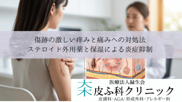 傷跡の激しい痒みと痛みへの対処法｜ステロイド外用薬と保湿による炎症抑制