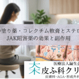 白斑の塗り薬・コレクチム軟膏とステロイド｜JAK阻害薬の効果と副作用