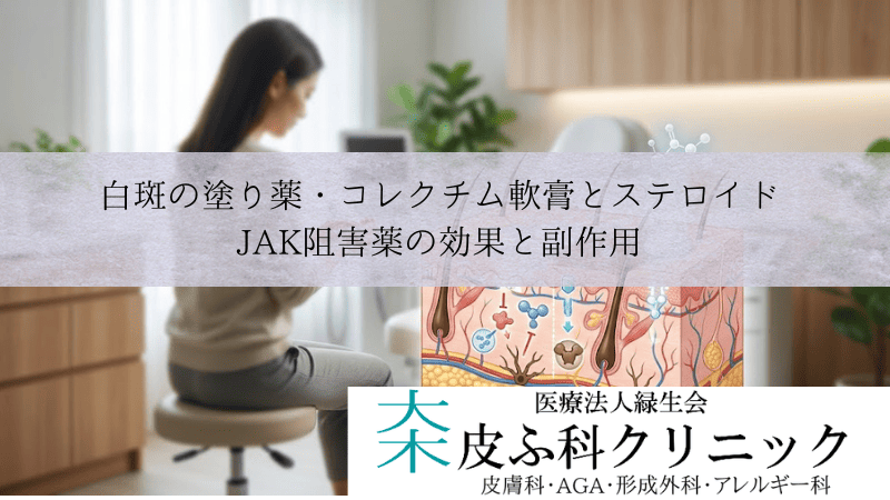 白斑の塗り薬・コレクチム軟膏とステロイド｜JAK阻害薬の効果と副作用