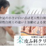 腕や足の小さい白い点は老人性白斑？｜尋常性白斑との違いと加齢による変化