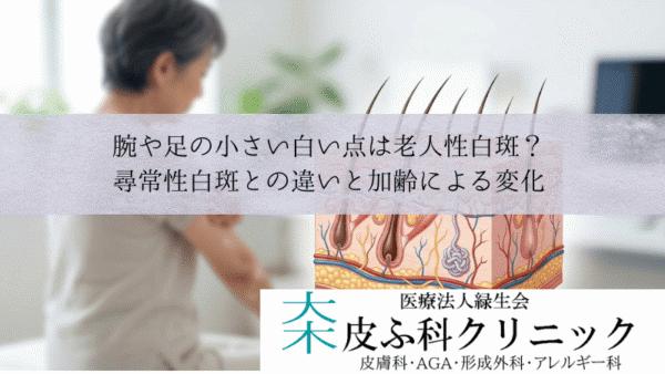 腕や足の小さい白い点は老人性白斑？｜尋常性白斑との違いと加齢による変化