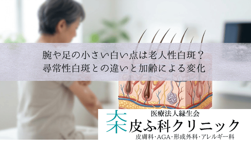 腕や足の小さい白い点は老人性白斑？｜尋常性白斑との違いと加齢による変化