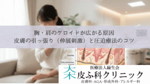 胸・肩のケロイドが広がる原因|皮膚の引っ張り(伸展刺激)と圧迫療法のコツ