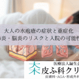 大人の水疱瘡の症状と重症化｜肺炎・脳炎のリスクと入院の可能性