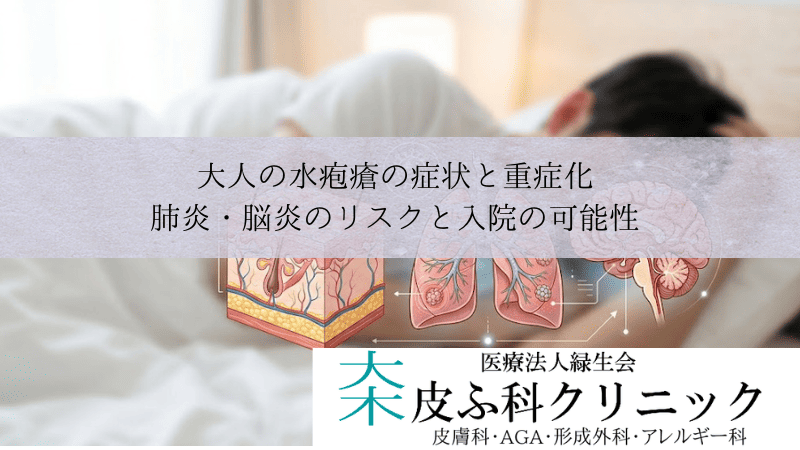 大人の水疱瘡の症状と重症化｜肺炎・脳炎のリスクと入院の可能性