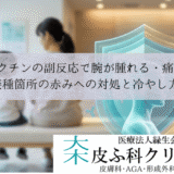 ワクチンの副反応で腕が腫れる・痛い｜接種箇所の赤みへの対処と冷やし方