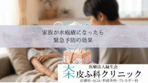 家族が水疱瘡になったら接触後72時間以内にワクチン接種|緊急予防の効果