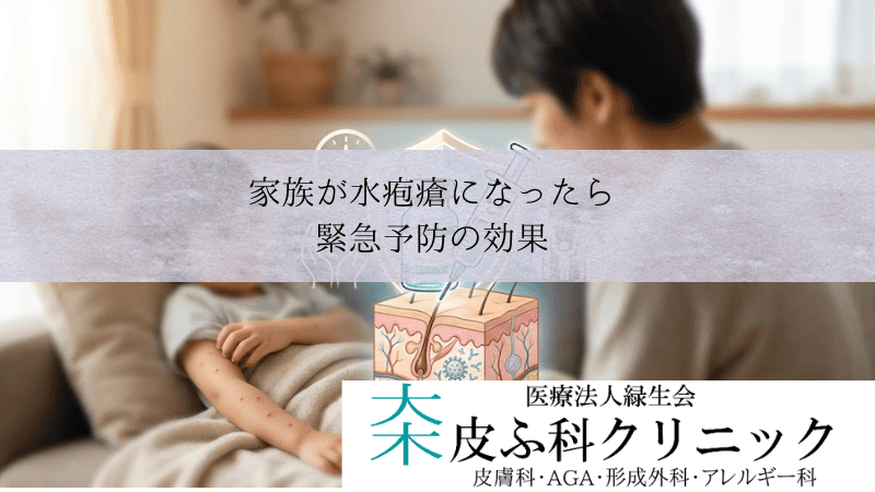 家族が水疱瘡になったら接触後72時間以内にワクチン接種|緊急予防の効果