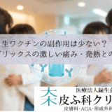 生ワクチンの副作用は少ない？｜シングリックスの激しい痛み・発熱との比較