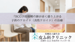 『BCG予防接種の跡が赤く盛り上がる|子供のケロイド(真性ケロイド)の治療
