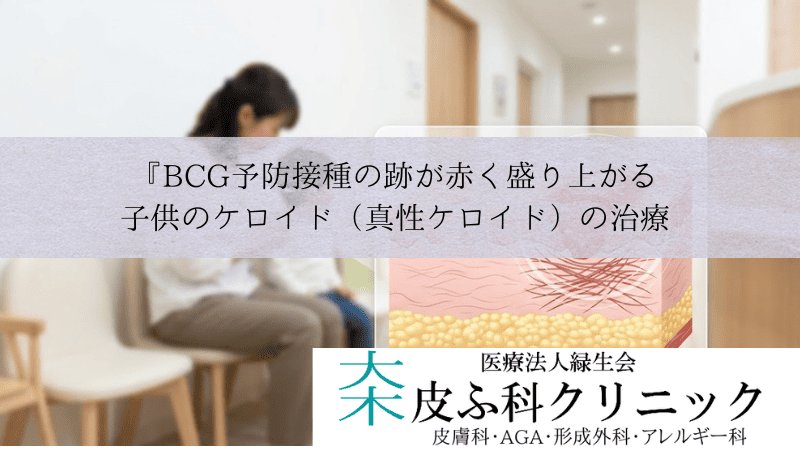 『BCG予防接種の跡が赤く盛り上がる|子供のケロイド(真性ケロイド)の治療