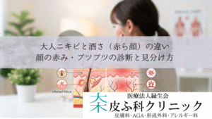 大人ニキビと酒さ(赤ら顔)の違い|顔の赤み・ブツブツの診断と見分け方