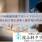 手汗の保険適用薬アポハイドローション｜寝る前に塗る効果と副作用の痒み