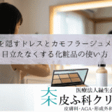 白斑を隠すドレスとカモフラージュメイク｜目立たなくする化粧品の使い方