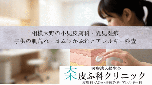 相模大野の小児皮膚科・乳児湿疹｜子供の肌荒れ・オムツかぶれとアレルギー検査