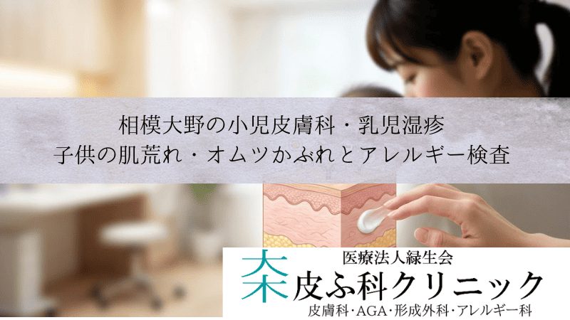 相模大野の小児皮膚科・乳児湿疹|子供の肌荒れ・オムツかぶれとアレルギー検査
