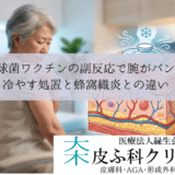 肺炎球菌ワクチンの副反応で腕がパンパンに腫れる｜冷やす処置と蜂窩織炎との違い