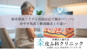 肺炎球菌ワクチンの副反応で腕がパンパンに腫れる|冷やす処置と蜂窩織炎との違い