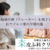 大人の水疱瘡の跡（クレーター）を残さない治療｜抗ウイルス薬の早期内服