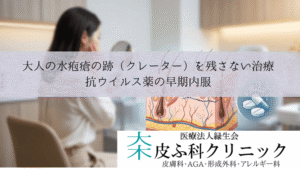 大人の水疱瘡の跡（クレーター）を残さない治療｜抗ウイルス薬の早期内服