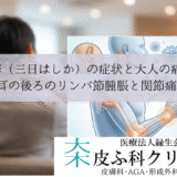 風疹（三日はしか）の症状と大人の痛み｜耳の後ろのリンパ節腫脹と関節痛