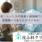 錆びた釘・土いじりの怪我と破傷風ワクチン｜受傷後いつまでに打つべきか