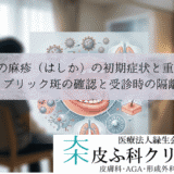 大人の麻疹（はしか）の初期症状と重症化｜コプリック斑の確認と受診時の隔離