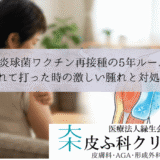肺炎球菌ワクチン再接種の5年ルール｜忘れて打った時の激しい腫れと対処法
