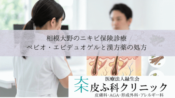 相模大野のニキビ保険診療｜ベピオ・エピデュオゲルと漢方薬の処方
