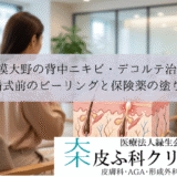 相模大野の背中ニキビ・デコルテ治療｜結婚式前のピーリングと保険薬の塗り方
