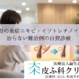 相模大野の重症ニキビ・イソトレチノイン療法｜治らない難治例の自費診療
