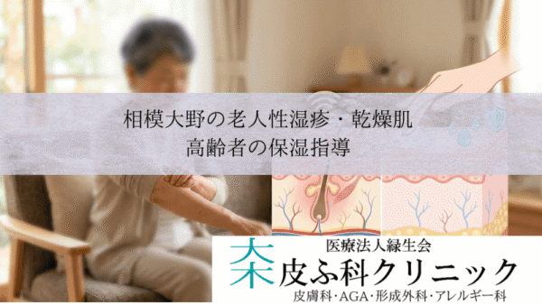 相模大野の老人性湿疹・乾燥肌（皮脂欠乏性湿疹）｜高齢者の保湿指導