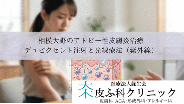 相模大野のアトピー性皮膚炎治療｜デュピクセント注射と光線療法（紫外線）