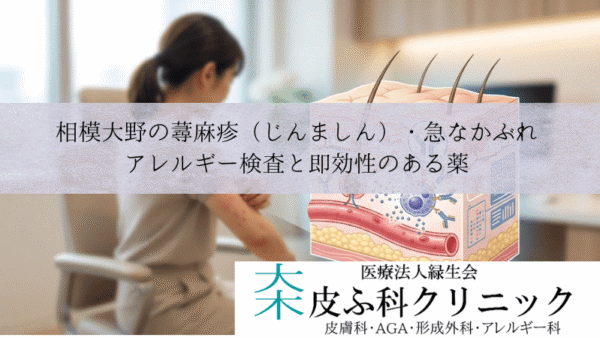 相模大野の蕁麻疹（じんましん）・急なかぶれ｜アレルギー検査と即効性のある薬