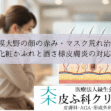 相模大野の顔の赤み・マスク荒れ治療｜化粧かぶれと酒さ様皮膚炎の対応
