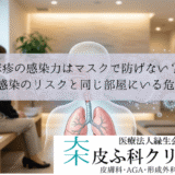 麻疹の感染力はマスクで防げない？｜空気感染のリスクと同じ部屋にいる危険性